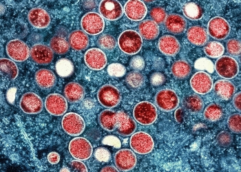 Monkeypox virus microscopic particles