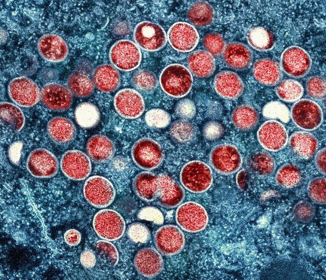 Monkeypox virus microscopic particles