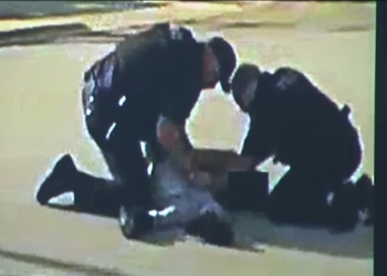 Boy beaten by the cops