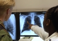 Xray