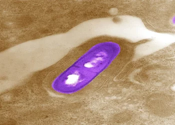 The listeria outbreak in 6 US states is linked to deli cheese and meat
