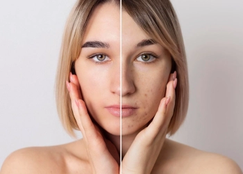 a comparison of women's face