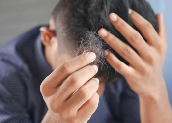 Smoking’s Impact on Hair Health: What You Can Do About It